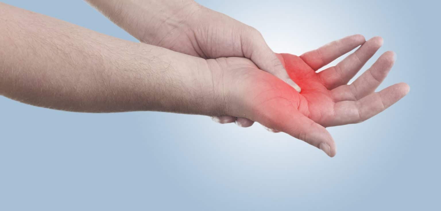 SYNDROME METACARPIEN A-AMCOS